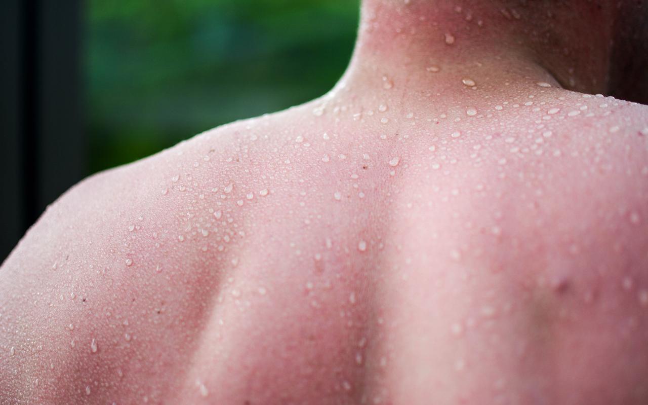 Je lichaam past zich vanzelf aan de hitte aan, onder meer door over heel je lichaam te zweten. Foto: Shutterstock Je lichaam past zich vanzelf aan de hitte aan, onder meer door over heel je lichaam te zweten. Foto: Shutterstock