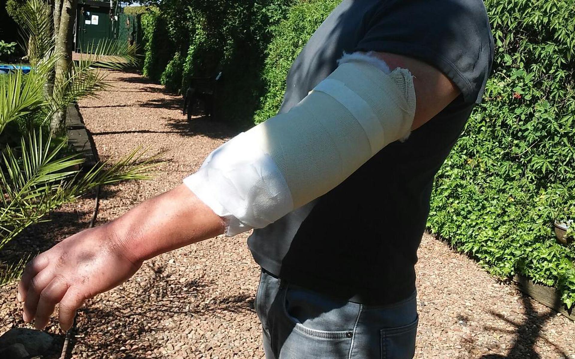 Wim Vroom is door het oog van de naald gekropen. Zijn arm zit nu in het gips. Foto: DvhN/eigen foto