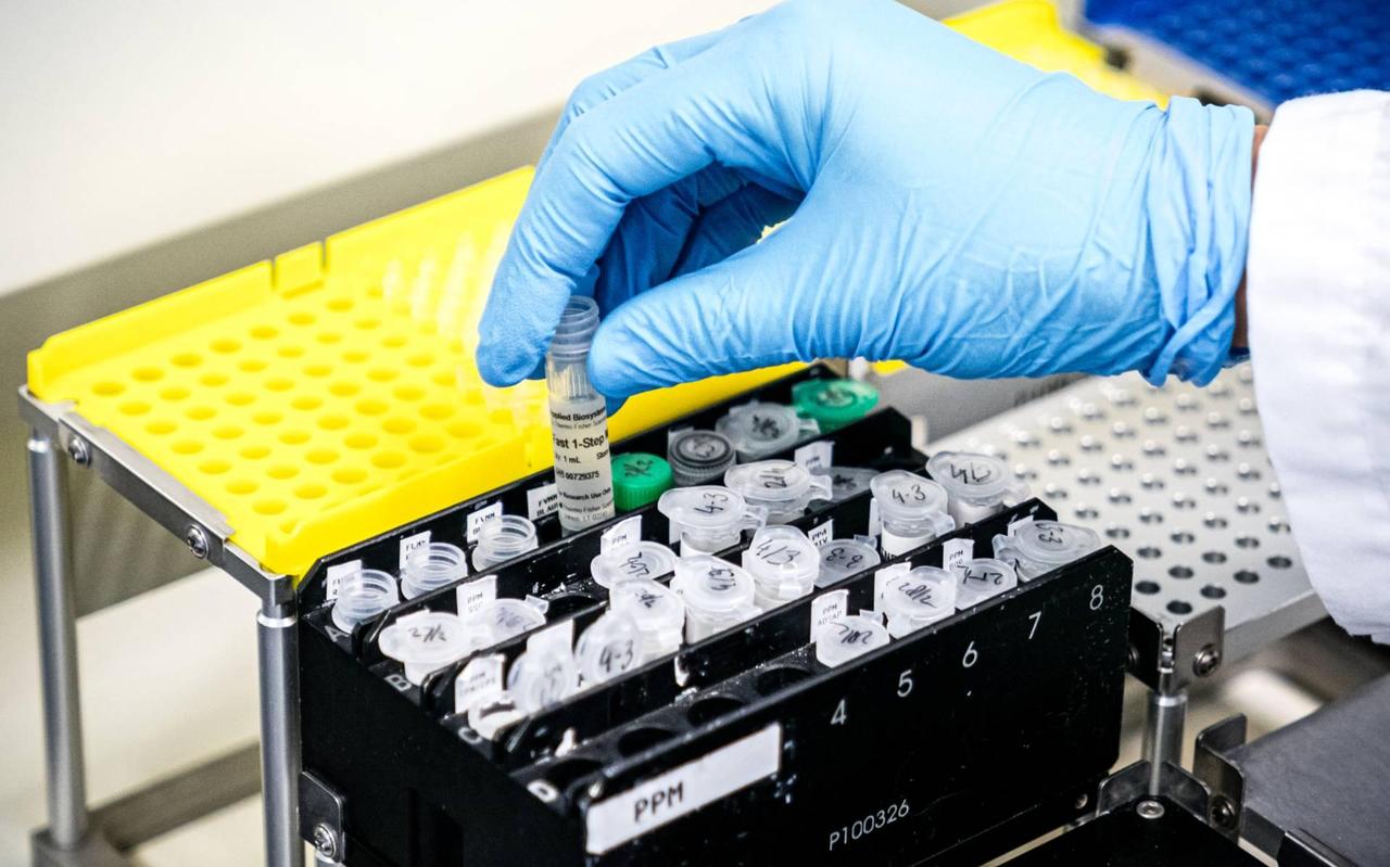 Er is een verband tussen DNA en de impact van corona op een patiënt. Er is een verband tussen DNA en de impact van corona op een patiënt.