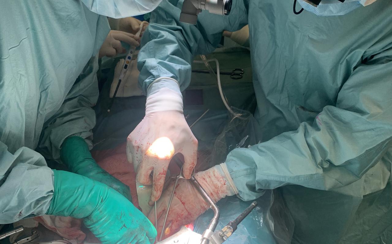 Chirurgen in het UMCG voeren de levertransplantatie uit.
