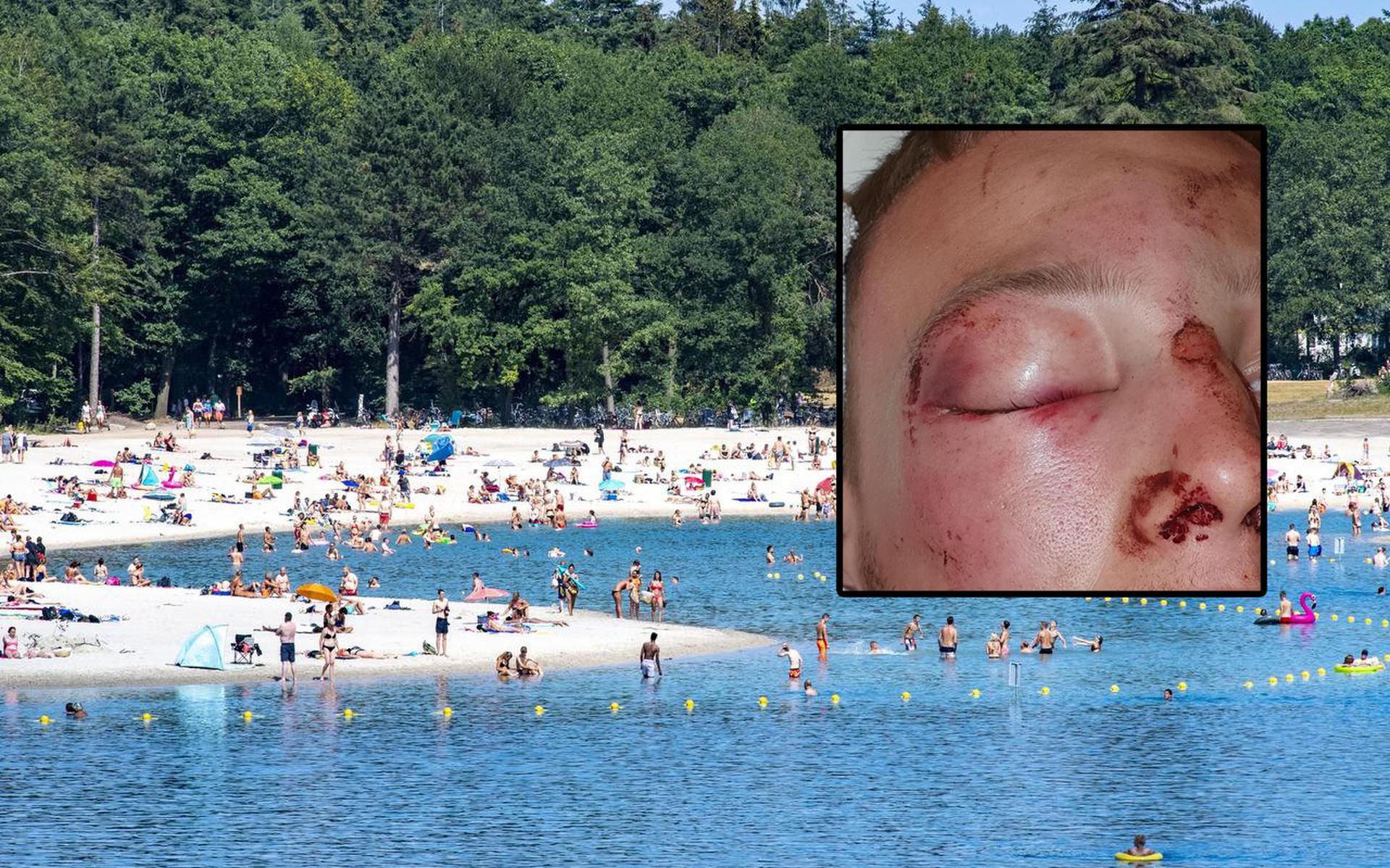 De 21-jarige jongen werd zwaar mishandeld bij de zwemplas.