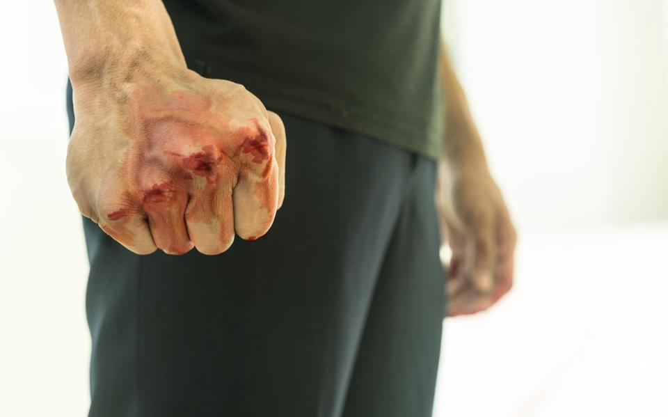 Slachtoffer op klaarlichte dag zwaar mishandeld nadat hij overlastgever in Emmer-Compascuum aansprak. Foto: Shutterstock